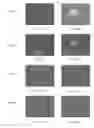 Fig. 15 - Medical device applications of nanostructured surfaces