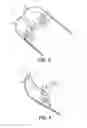 Fig. 04 - TAMPON APPLICATOR