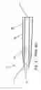 Fig. 03 - Weighted infusion sleeve