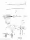 Fig. 02 - METHOD AND APPARATUS FOR REPAIRING A TENDON OR LIGAMENT