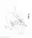 Fig. 11 - METHOD AND APPARATUS FOR REPAIRING A TENDON OR LIGAMENT