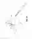 Fig. 13 - METHOD AND APPARATUS FOR REPAIRING A TENDON OR LIGAMENT