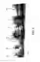Fig. 15 - METHOD AND APPARATUS FOR REPAIRING A TENDON OR LIGAMENT