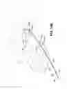 Fig. 41 - METHOD AND APPARATUS FOR REPAIRING A TENDON OR LIGAMENT