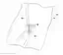 Fig. 01 - METHOD OF LOCATING VESSEL PUNCTURE ACCESS SITES VIA TATTOO OR PERMANENT MARKING