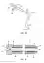Fig. 02 - Slittable or Removable Valves and Apparatus and Methods for Making and Using Them