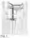 Fig. 02 - Catheter Leg Bag Support Device