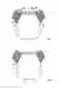 Fig. 02 - Reusable diaper