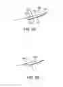 Fig. 09 - GUIDEWIRE POSITIONING DEVICE