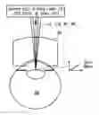 Fig. 01 - Method and apparatus for automated placement of scanned laser capsulorhexis incisions