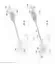 Fig. 09 - Methods and apparatus for treating vertebral fractures