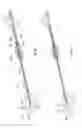 Fig. 12 - Methods and apparatus for treating vertebral fractures