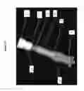 Fig. 10 - APPARATUS FOR DELIVERY OF VISCOUS MATERIAL DURING SURGERY