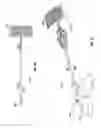 Fig. 08 - Methods and apparatus for treating vertebral fractures