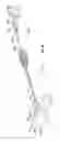 Fig. 09 - Methods and apparatus for treating vertebral fractures