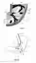 Fig. 02 - ENDOLUMINAL ROBOTIC SYSTEM