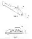 Fig. 09 - Therapeutic agent delivery system, device and method for localized application of therapeutic substances to a biological conduit