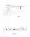 Fig. 02 - Bone plate