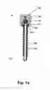Fig. 08 - Spinal rod and screw securing apparatus and method