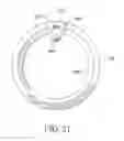 Fig. 16 - Implantable lead with isolated contact coupling