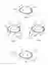 Fig. 06 - Artificial valve