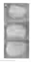 Fig. 01 - BIOLOGICALLY DERIVED COMPOSITE TISSUE ENGINEERING