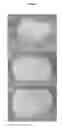Fig. 02 - BIOLOGICALLY DERIVED COMPOSITE TISSUE ENGINEERING
