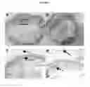 Fig. 06 - BIOLOGICALLY DERIVED COMPOSITE TISSUE ENGINEERING