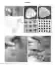 Fig. 07 - BIOLOGICALLY DERIVED COMPOSITE TISSUE ENGINEERING