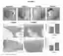 Fig. 08 - BIOLOGICALLY DERIVED COMPOSITE TISSUE ENGINEERING