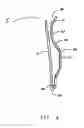 Fig. 02 - Cuff Protector