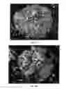 Fig. 06 - Methods and compositions using calcium carbonate
