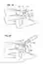 Fig. 06 - DELINEATING NAIL FOR NAIL TREATMENT APPLICATIONS AND METHOD THEREFOR