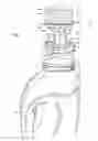 Fig. 02 - Cap and spout combo