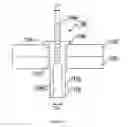 Fig. 02 - Device for blind fixation