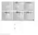 Fig. 01 - STIMULATABLE ASYMMETRICAL POLYMERSOME