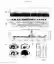 Fig. 02 - Genetic alterations associated with autism and the autistic phenotype and methods of use thereof for the diagnosis and treatment of autism