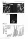 Fig. 02 - Differential gene expression in physiological and pathological angiogenesis