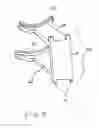 Fig. 09 - Knee rehabilitation exercise device