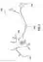Fig. 02 - Methods for  Therapeutic Renal  Denervation