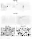 Fig. 01 - GLUTAMIC ACID DECARBOXYLASE (GAD) BASED DELIVERY SYSTEM