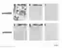 Fig. 03 - GLUTAMIC ACID DECARBOXYLASE (GAD) BASED DELIVERY SYSTEM