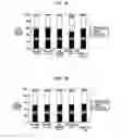 Fig. 08 - GLUTAMIC ACID DECARBOXYLASE (GAD) BASED DELIVERY SYSTEM
