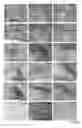 Fig. 30 - GLUTAMIC ACID DECARBOXYLASE (GAD) BASED DELIVERY SYSTEM