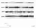Fig. 33 - GLUTAMIC ACID DECARBOXYLASE (GAD) BASED DELIVERY SYSTEM