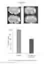 Fig. 02 - METHODS FOR THE PREVENTION AND TREATMENT OF CEREBRAL ISCHEMIA