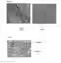 Fig. 77 - PROMOTERS EXHIBITING ENDOTHELIAL CELL SPECIFICITY AND METHODS OF USING SAME FOR REGULATION OF ANGIOGENESIS