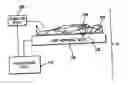 Fig. 01 - System and method of aquiring blood-vessel data