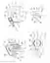 Fig. 09 - Protective device for an injection needle