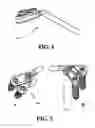 Fig. 02 - Bone fixation assembly
